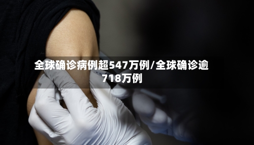 全球确诊病例超547万例/全球确诊逾718万例